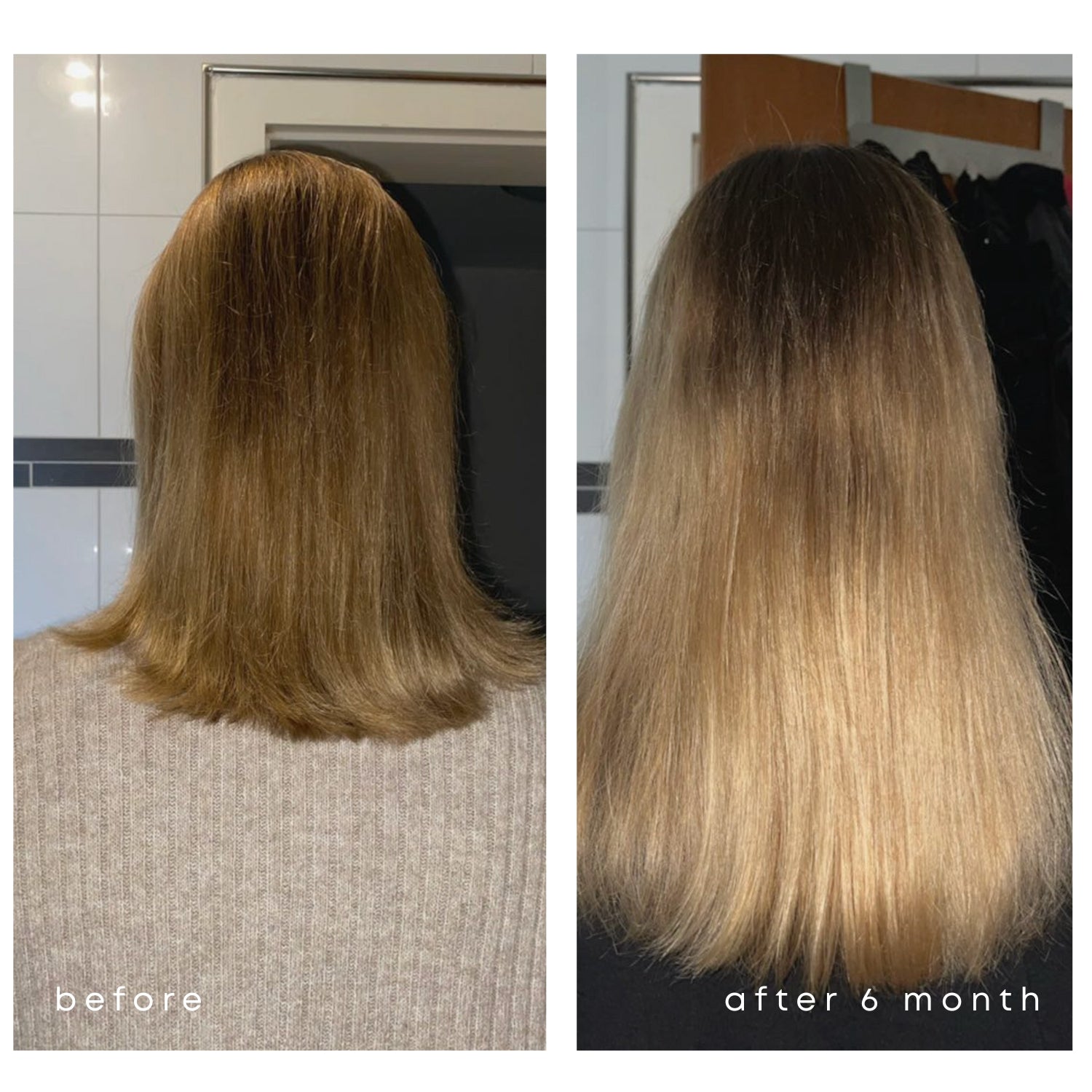 ALL ABOUT HAIR GROWTH SET - hair serum + hair vitamins + scalp massage brush