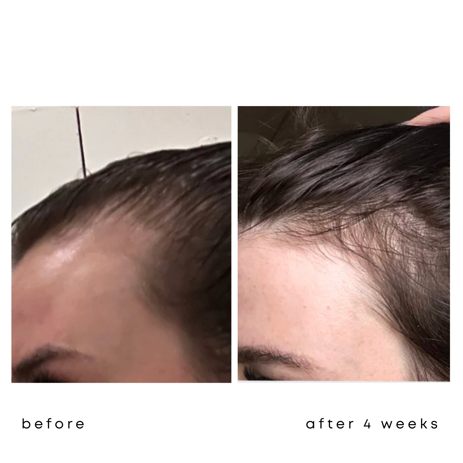 ALL ABOUT HAIR GROWTH SET - Haarserum + Haarvitamine + Kopfmassagebürste