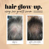 HAIR GROWTH SERUM - Haarwachstumsserum