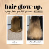 HAIR GROWTH SERUM - Haarwachstumsserum