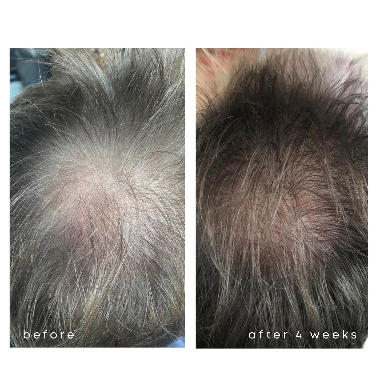 HAIR GROWTH SERUM - Haarwachstumsserum