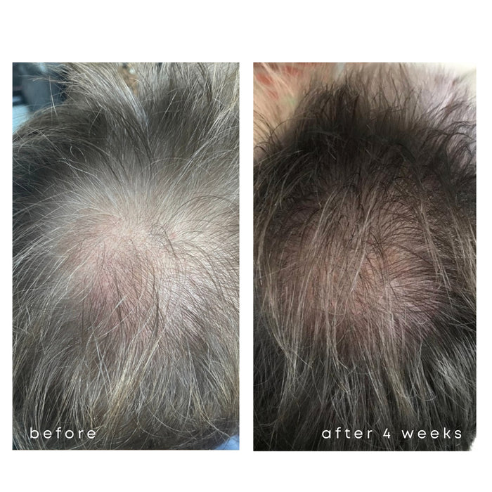 Vorher Nachher Ergebnis 2